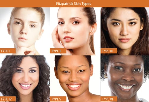skin-types