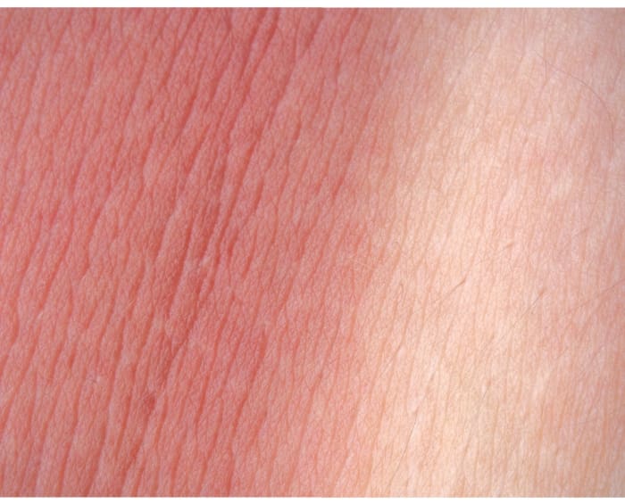 10 Things About…Burns