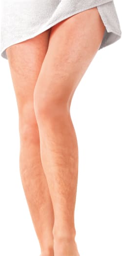 hairy-legs