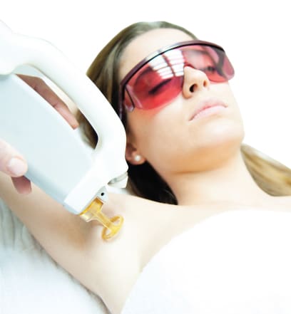 laser