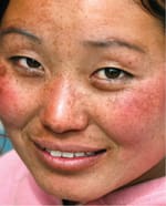 sensitivities-of-ethnicities