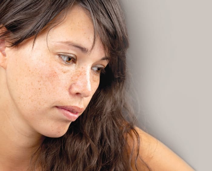 Hormonally Driven Pigmentation in Ethnic Skin