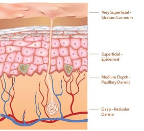 derma