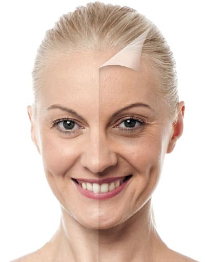 peel