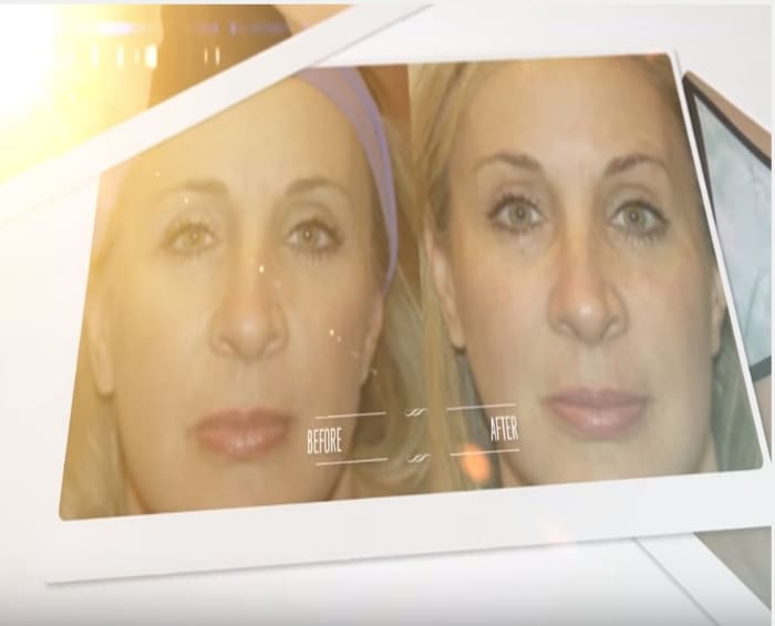 Video: BeforeAfter video for facebook