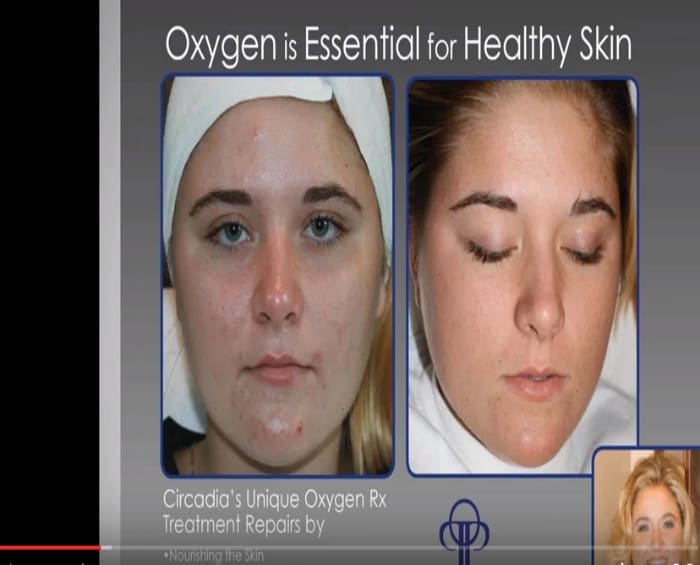 Video: Cocoa Enzyme and Oxygen Webinar