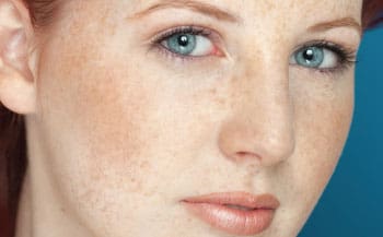 closeup