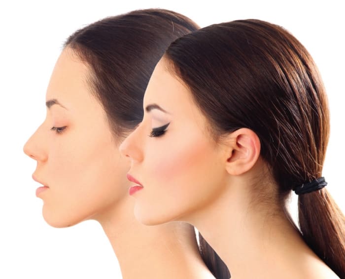Post-Treatment  Makeup Application