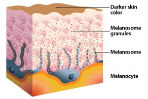 graphic1