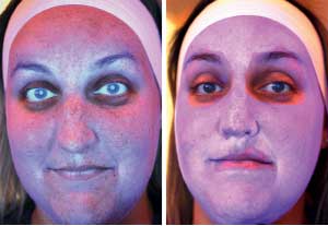 before-after