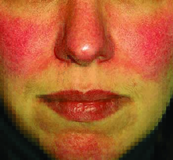 herron6