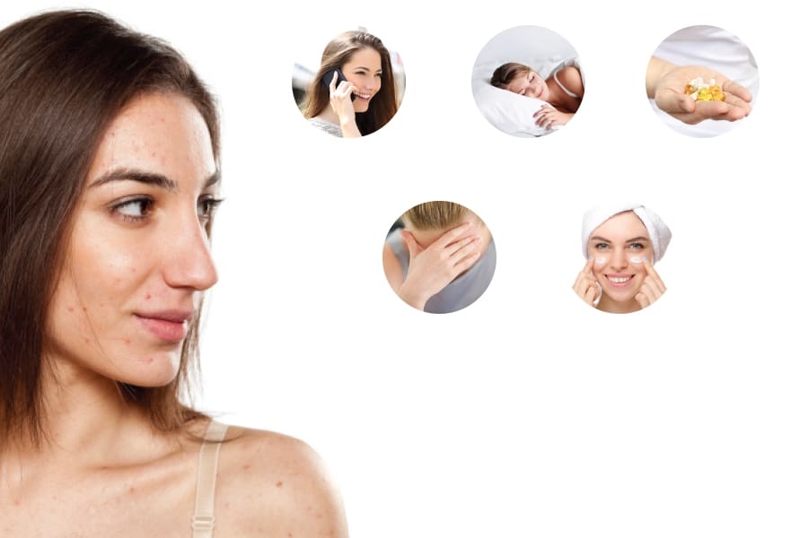 The Pimple Puzzle: Overlooked Causes of Breakouts