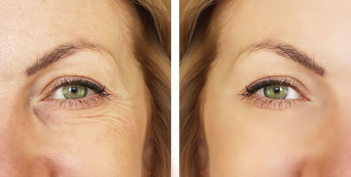 Get the Picture: The Benefits of Using Imaging in the Spa