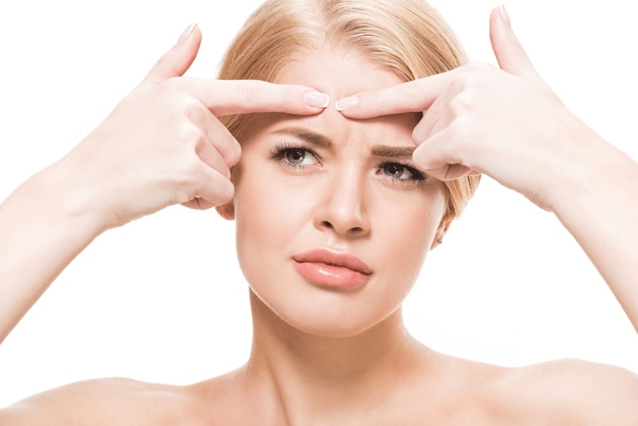 Dispelling the Top 3 Acne Myths