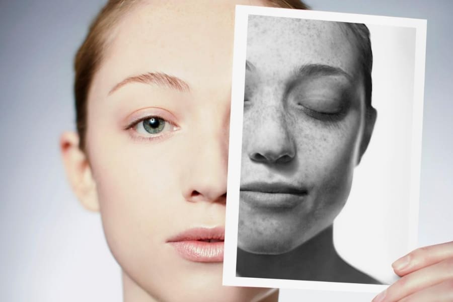 True Healing: Treating and Healing Sun Damaged Skin