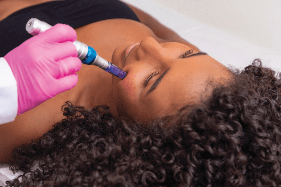Need to Know: Advanced Services for Melanin Rich Skin 