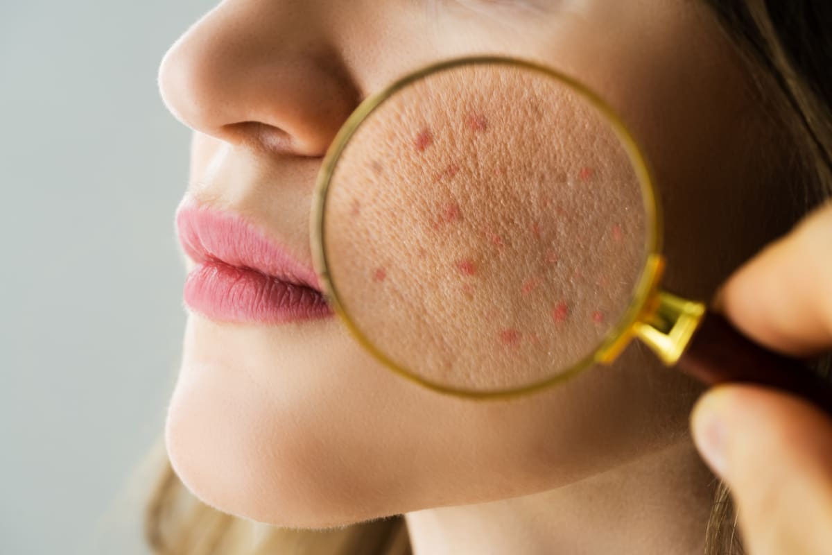 Ahead of the Curve: A Proactive Approach to Skin Health 